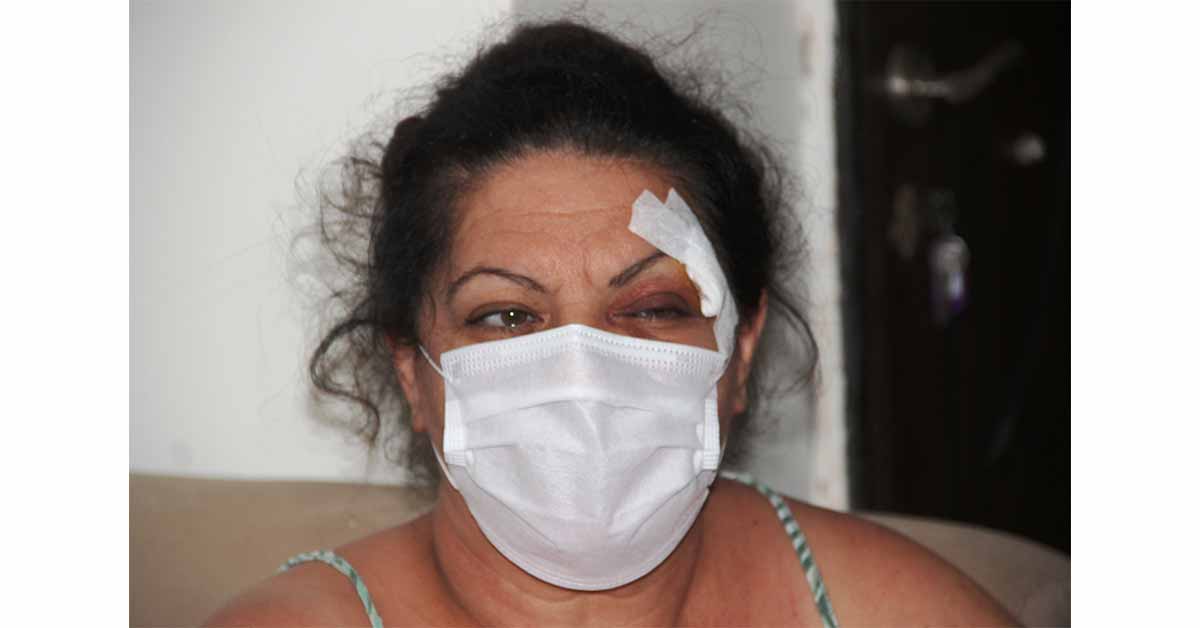 Tanımadığı kadını güpegündüz bayıltana kadar dövdü 2 Kadına Şiddet