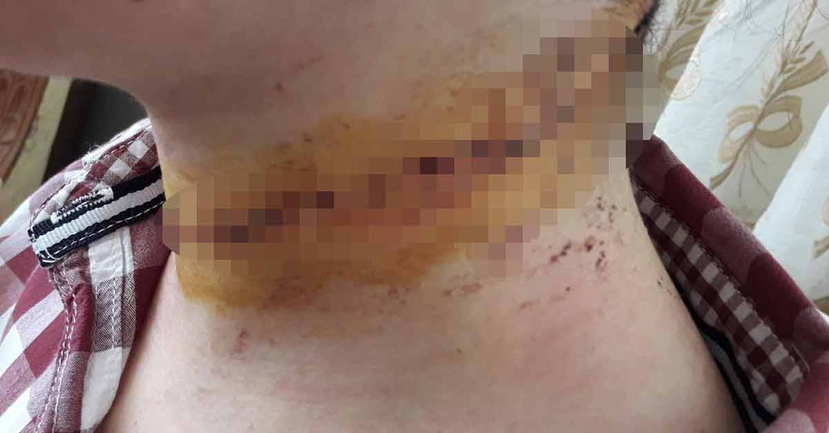 Boğazını Kestiği Eşini Eşarpla Boğmaya Çalıştı 2 koca dehseti