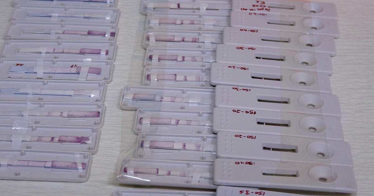 Yeni Covid-19 Testi Dünyada İlk Kez Türkiye Buldu 1 test-kiti-yeni