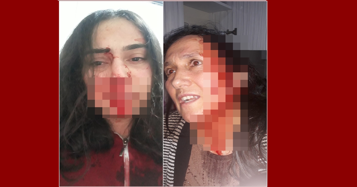 Annesini ve kız kardeşini hastanelik etti 1 aaaa 1