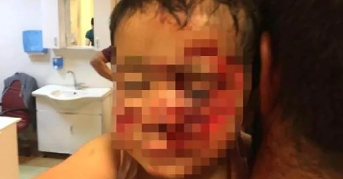 Köpeklerin saldırısında ölen çocuk defnedildi 1 Köpeklerin Saldırısına Uğrayan çocuk Hayatını Kaybetti