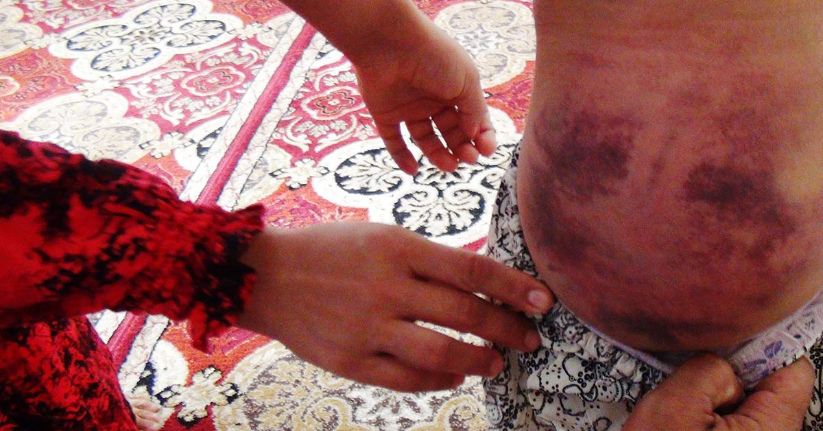 Urfa'daki O Cani Baba İşkenceden Yargılanacak 4 Çocukların İşkence Eden Baba