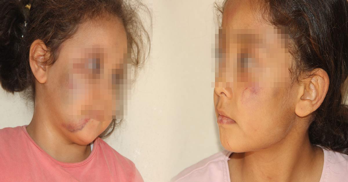 Urfa'daki O Cani Baba İşkenceden Yargılanacak 1 Çocukların İşkence Eden Baba