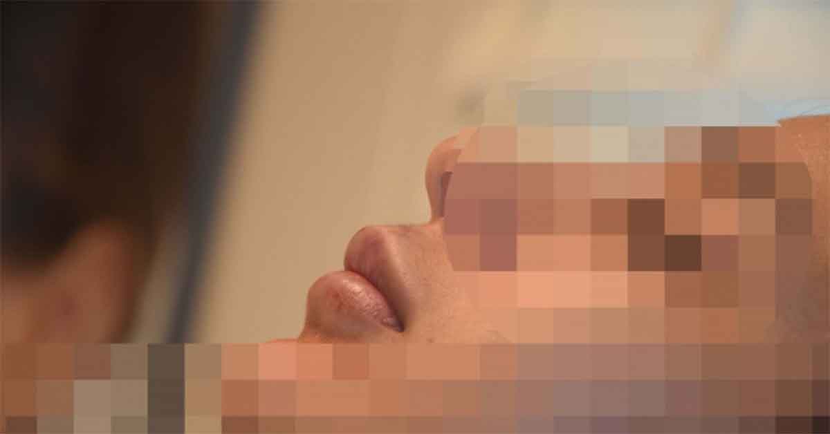 Koronalı botoks partisini andıran ortamda dudağından oluyordu 1 Koronalı botoks partisini andıran ortamda dudağından oluyordu