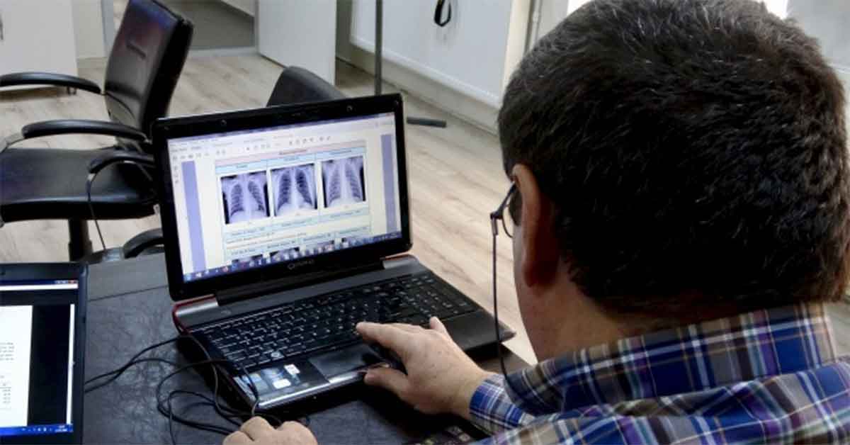 Korona virüs yüzde yüz teşhis edilebilecek 1 Korona virüs yüzde yüz teşhis edilebilecek