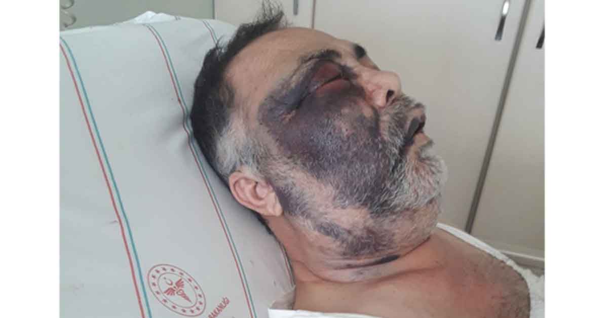 Yüzde 90 engelli vatandaş olayında flaş gelişme