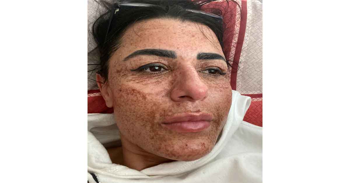 Önüne çıkan güzellik salonu ilanı yüzünü yaktı 2 Önüne çıkan güzellik salonu ilanı yüzünü yaktı