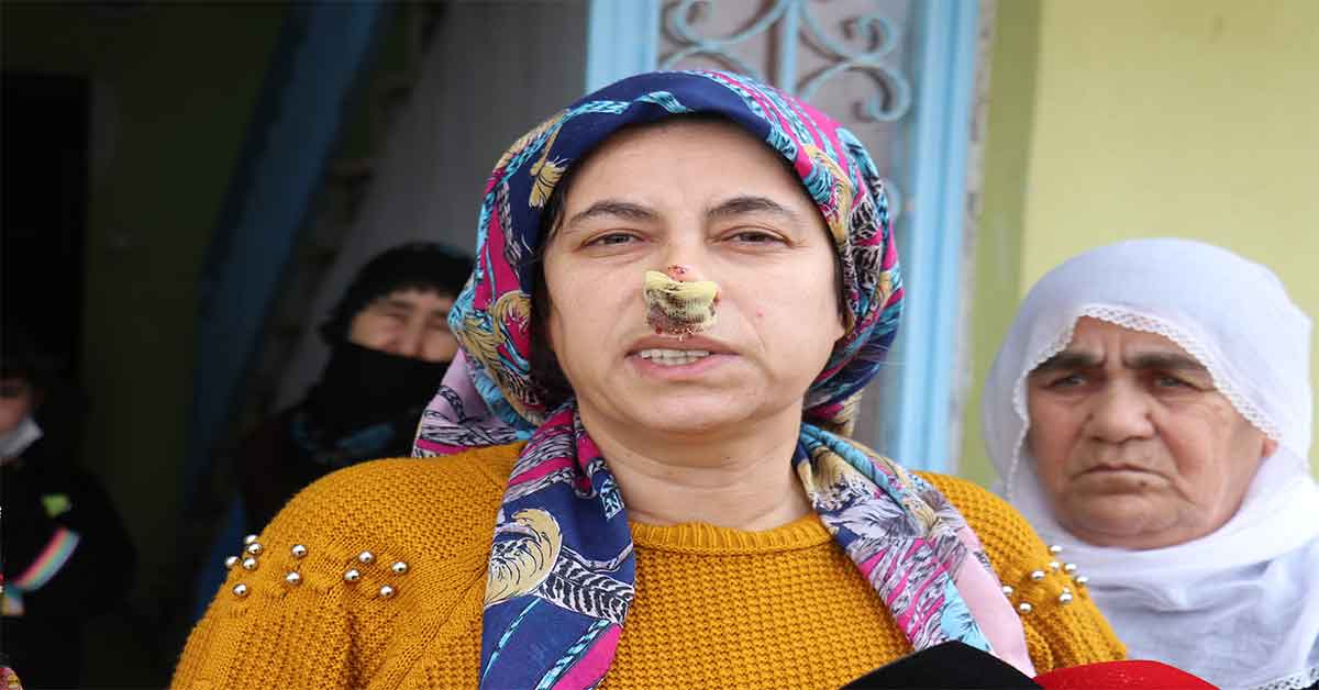 Sokak köpeklerinin saldırdığı kadın yaralandı