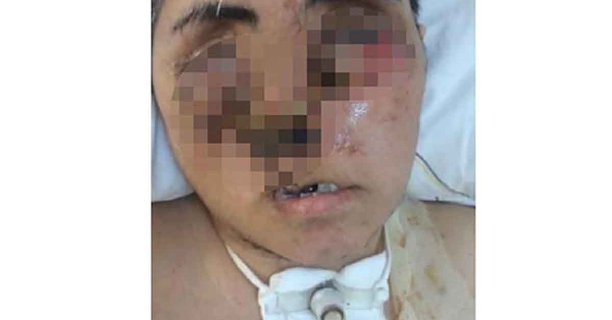 Eniştesinin saldırısı sonucu ağır yaralandı, yüzü tanınmayacak hale geldi 1 Eniştesinin saldırısı sonucu ağır yaralandı