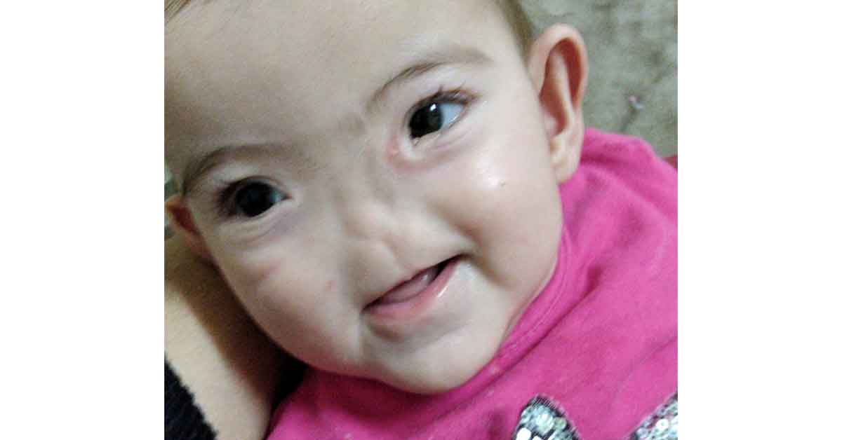 Solunum yolları bulunmayan kardeşlerin zorlu hayatı 2 Solunum yolları bulunmayan kardeşlerin zorlu hayatı