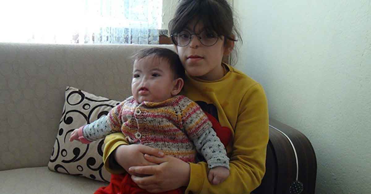 Solunum yolları bulunmayan kardeşlerin zorlu hayatı 1 Solunum yolları bulunmayan küçük kızın zorlu hayatı