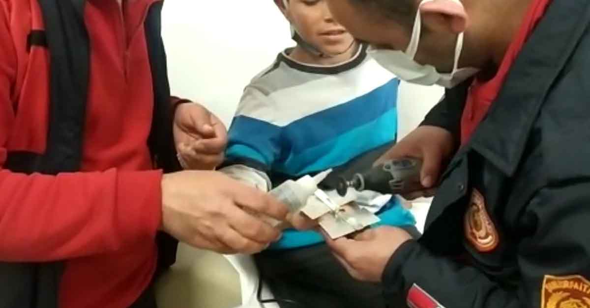 Urfa'da çocuğun parmağındaki yüzük kesilerek çıkartıldı