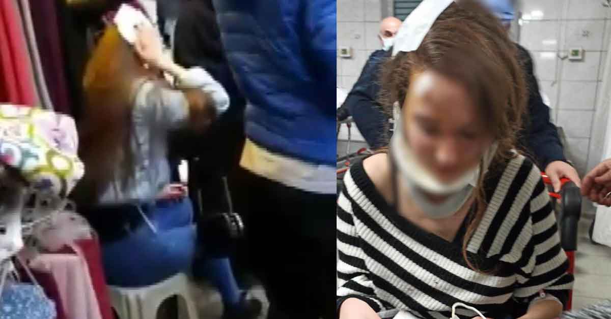 Genç kız, 'Muşta' ile darp edildi 1 musta darp