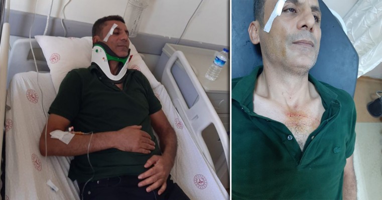 Urfa'da Sağlık çalışanına darpta 3 gözaltı 1 20210818082202 12859 54238