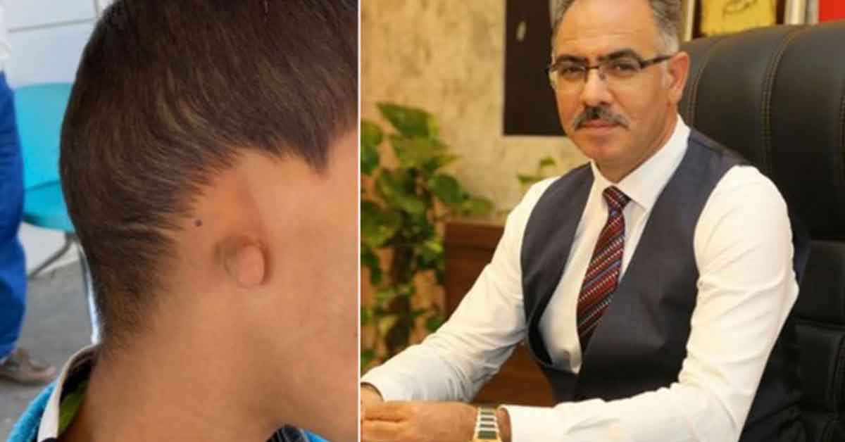 Başkan Kuş, Urfalı Çocuğa Duyarsız Kalmadı