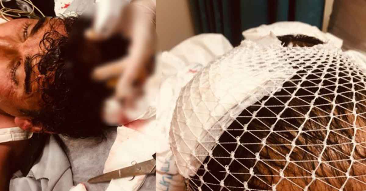 Urfa'da Hastane Güvenliğine Saldırı! 8 Yaralı 1 kavga guvenlik urfa
