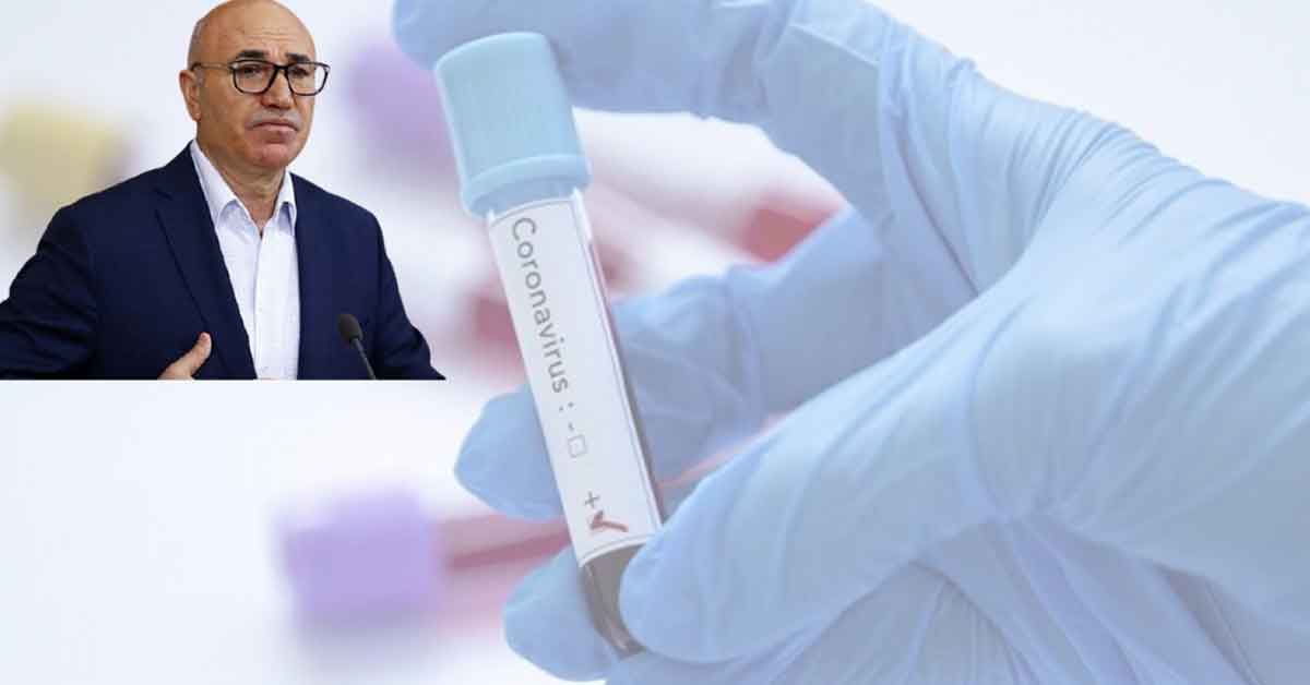 Şanlıurfalı vekilin testi pozitif 1 Şanlıurfalı vekilin testi pozitif