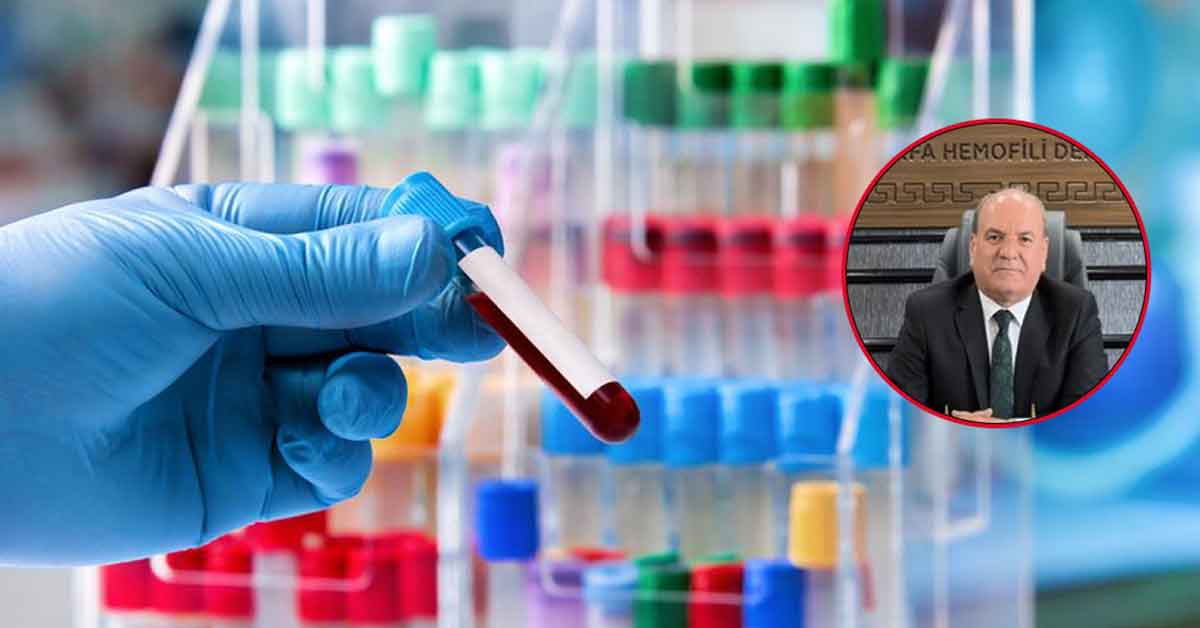 Urfa’da kan hastalığı bulunan 2 bin kişi doktorsuz kaldı 1 Urfa’da kan hastalığı bulunan 2 bin kişi doktorsuz kaldı