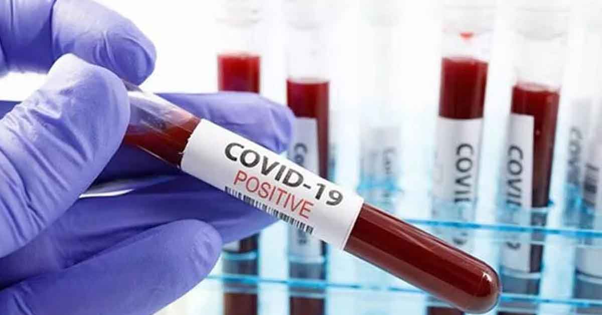 Haftalık koronavirüs tablosu açıklandı!