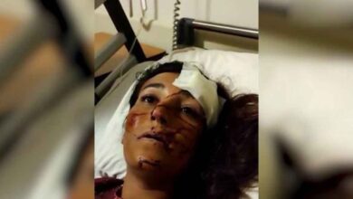Urfa'da taciz için takip edilen kadına otomobil çarptı