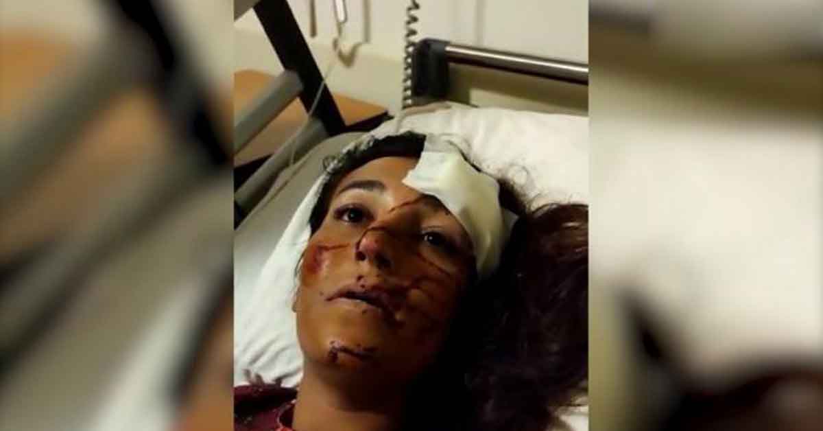 Urfa'da taciz için takip edilen kadına otomobil çarptı